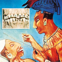 Звук у стоматолога: сверлят зубы